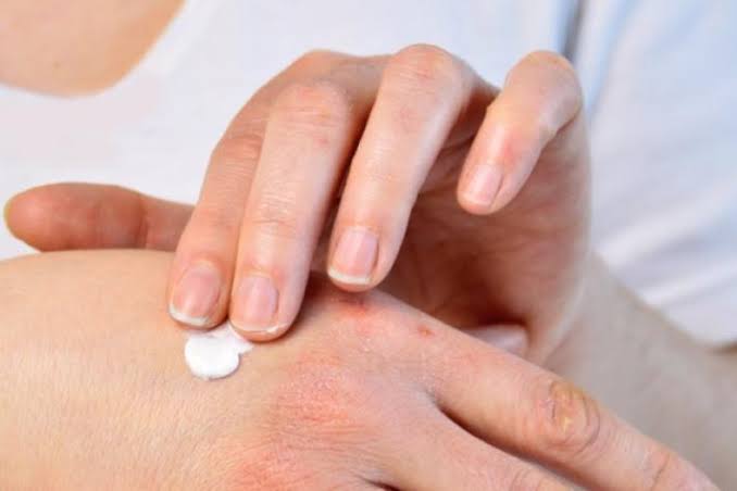 Best Hand Creams for Dry Skin: Your Complete Guide